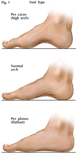 Measure sale foot arch